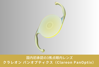 クラレオン パンオプティクス （Clareon PanOptix）