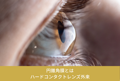 円錐角膜・ハードコンタクトレンズ外来