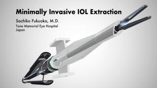 Minimally Invasive IOL Extraction