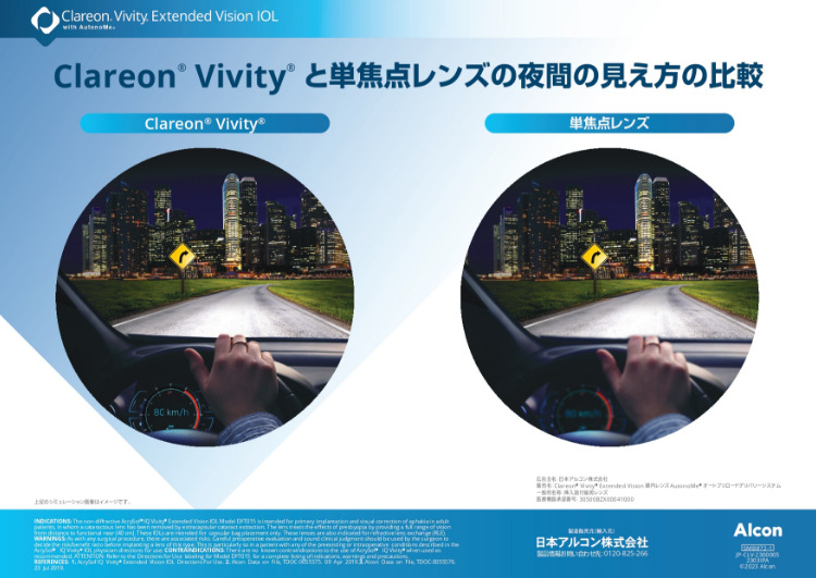 クラレオンビビティ（Clareon Vivity）と単焦点眼内レンズの夜間の見え方の比較